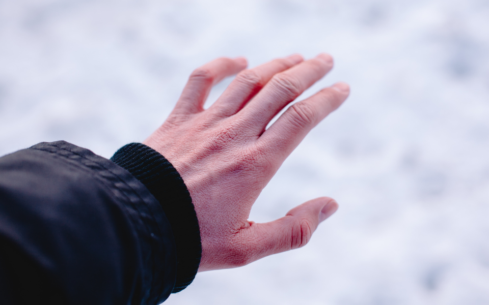 dry winter skin on hands before using tallow on skin