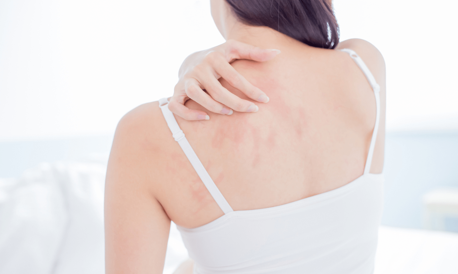 Women scratching her back because of her eczema  