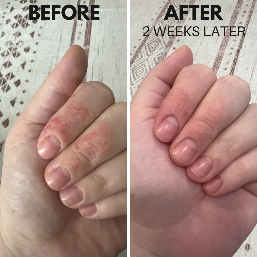 showing hands before and after  weeks of using tallow moisturizer