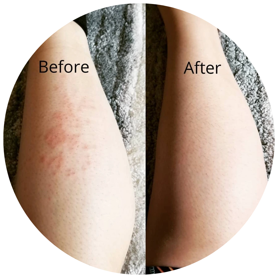 showing two sets of legs for before and after using tallow skincare
